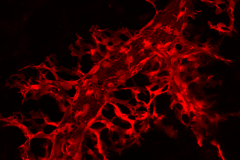 Medical imagery showing a network of damaged blood vessels in lungs